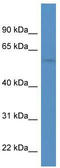 Cholinergic Receptor Nicotinic Delta Subunit antibody, TA338498, Origene, Western Blot image 