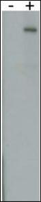 Leucine Rich Repeat Kinase 2 antibody, 62-662, ProSci, Immunohistochemistry paraffin image 