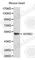 Adrenoceptor Beta 2 antibody, A1295, ABclonal Technology, Western Blot image 