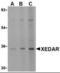 Ectodysplasin A2 Receptor antibody, GTX38774, GeneTex, Western Blot image 