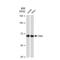 Checkpoint Kinase 2 antibody, GTX00927, GeneTex, Western Blot image 