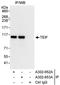 SCY1 Like Pseudokinase 1 antibody, A302-652A, Bethyl Labs, Immunoprecipitation image 