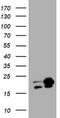 NME/NM23 Nucleoside Diphosphate Kinase 1 antibody, M01334-1, Boster Biological Technology, Western Blot image 