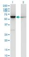 Cystathionine-Beta-Synthase antibody, H00000875-M02, Novus Biologicals, Western Blot image 