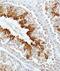 Zinc finger protein GLI3 antibody, NBP2-29627, Novus Biologicals, Immunohistochemistry paraffin image 