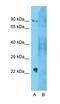 Coagulation Factor VIII antibody, orb333731, Biorbyt, Western Blot image 