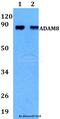 ADAM Metallopeptidase Domain 8 antibody, LS-C411876, Lifespan Biosciences, Western Blot image 