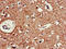 Cholinergic Receptor Muscarinic 5 antibody, LS-C677531, Lifespan Biosciences, Immunohistochemistry paraffin image 