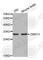 Zinc Finger Matrin-Type 3 antibody, A4928, ABclonal Technology, Western Blot image 