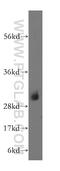 NADH:Ubiquinone Oxidoreductase Core Subunit S3 antibody, 15066-1-AP, Proteintech Group, Western Blot image 
