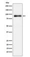 Lactotransferrin antibody, M00633-2, Boster Biological Technology, Western Blot image 