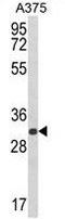 Deoxyribose-Phosphate Aldolase antibody, GTX81043, GeneTex, Western Blot image 