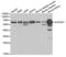 Aldehyde Dehydrogenase 4 Family Member A1 antibody, abx002029, Abbexa, Western Blot image 