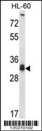 Syntaxin 6 antibody, 58-222, ProSci, Western Blot image 