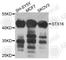 Syntaxin 16 antibody, A8168, ABclonal Technology, Western Blot image 