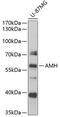 Anti-Mullerian Hormone antibody, 23-645, ProSci, Western Blot image 