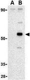 Apoptosis And Caspase Activation Inhibitor antibody, GTX31267, GeneTex, Western Blot image 