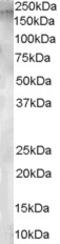 Glutamyl Aminopeptidase antibody, LS-B2758, Lifespan Biosciences, Western Blot image 