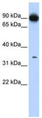 Protein Activator Of Interferon Induced Protein Kinase EIF2AK2 antibody, TA345848, Origene, Western Blot image 