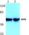 Arylsulfatase E antibody, A10294-1, Boster Biological Technology, Western Blot image 