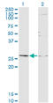 TGFB Induced Factor Homeobox 2 antibody, LS-C139517, Lifespan Biosciences, Western Blot image 