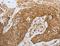 Creatine Kinase, M-Type antibody, LS-C405437, Lifespan Biosciences, Immunohistochemistry paraffin image 