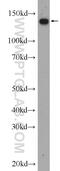 Non-SMC Condensin I Complex Subunit D2 antibody, 13382-1-AP, Proteintech Group, Western Blot image 