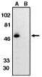 C-X3-C Motif Chemokine Receptor 1 antibody, MBS395675, MyBioSource, Western Blot image 