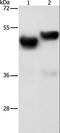 Archaelysin Family Metallopeptidase 1 antibody, LS-C402906, Lifespan Biosciences, Western Blot image 