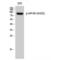 Eukaryotic Translation Initiation Factor 4B antibody, LS-C380871, Lifespan Biosciences, Western Blot image 