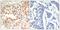 Cyclin Dependent Kinase 6 antibody, PA5-37517, Invitrogen Antibodies, Immunohistochemistry paraffin image 