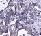 Cyclin Dependent Kinase 6 antibody, PB9995, Boster Biological Technology, Immunohistochemistry paraffin image 