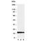 Lymphotoxin Alpha antibody, R30428, NSJ Bioreagents, Western Blot image 