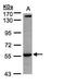 Interleukin 1 Receptor Type 1 antibody, GTX108494, GeneTex, Western Blot image 