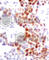 Activating Transcription Factor 2 antibody, AP0128, ABclonal Technology, Immunohistochemistry paraffin image 