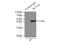 Actin Alpha 2, Smooth Muscle antibody, 14395-1-AP, Proteintech Group, Immunoprecipitation image 