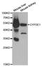 Cytochrome P450 Family 2 Subfamily E Member 1 antibody, orb48347, Biorbyt, Western Blot image 