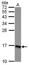 Ribosomal Protein Lateral Stalk Subunit P2 antibody, GTX101823, GeneTex, Western Blot image 