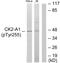 Casein Kinase 2 Alpha 1 antibody, PA5-38831, Invitrogen Antibodies, Western Blot image 