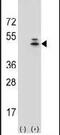Actin Gamma 1 antibody, PA5-13467, Invitrogen Antibodies, Western Blot image 