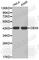 Chromobox 8 antibody, A2682, ABclonal Technology, Western Blot image 