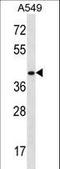 Homeobox D11 antibody, LS-C164990, Lifespan Biosciences, Western Blot image 