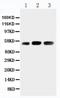 Kin17 DNA And RNA Binding Protein antibody, PA2238, Boster Biological Technology, Western Blot image 