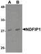 Nedd4 Family Interacting Protein 1 antibody, PA5-34421, Invitrogen Antibodies, Western Blot image 