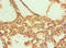 Calpain 1 antibody, LS-C375391, Lifespan Biosciences, Immunohistochemistry paraffin image 