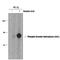 Tyrosine Hydroxylase antibody, PPS088, R&D Systems, Western Blot image 