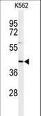 INO80 Complex Subunit B antibody, LS-C165233, Lifespan Biosciences, Western Blot image 