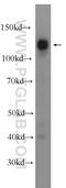 NCOA7 antibody, 23092-1-AP, Proteintech Group, Western Blot image 