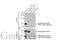 Androgen Receptor antibody, GTX636638, GeneTex, Western Blot image 
