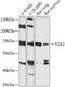 TOX High Mobility Group Box Family Member 2 antibody, 18-104, ProSci, Western Blot image 